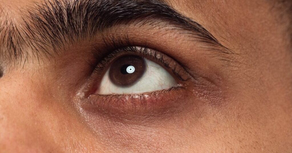 black eye treatment in Indore