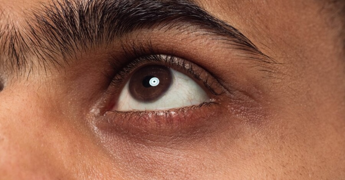 black eye treatment in Indore