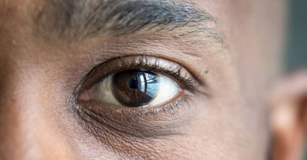 black eye treatment in Indore