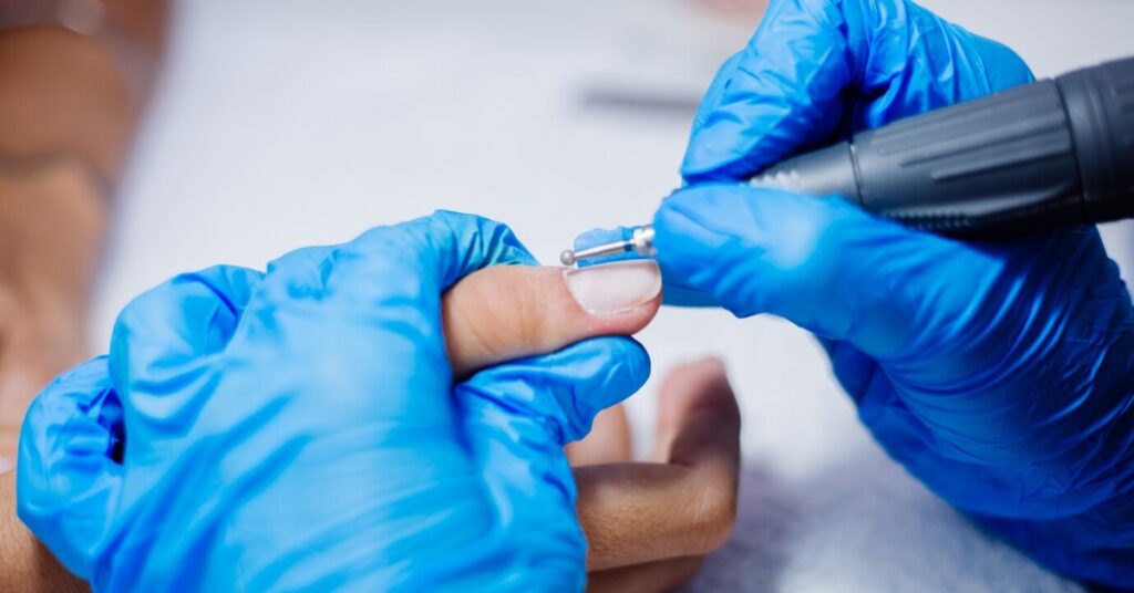 अंतर्वर्धित अंगूठे का नाखून