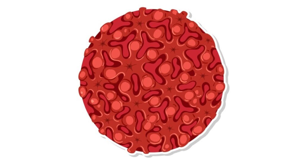 लिम्फोसाइटोसिस