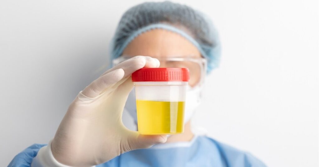 Protein in Urine