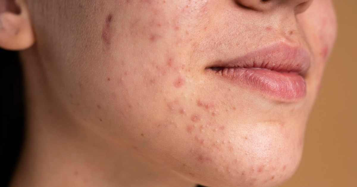 ओमेगा 3 की कमी के लक्षण