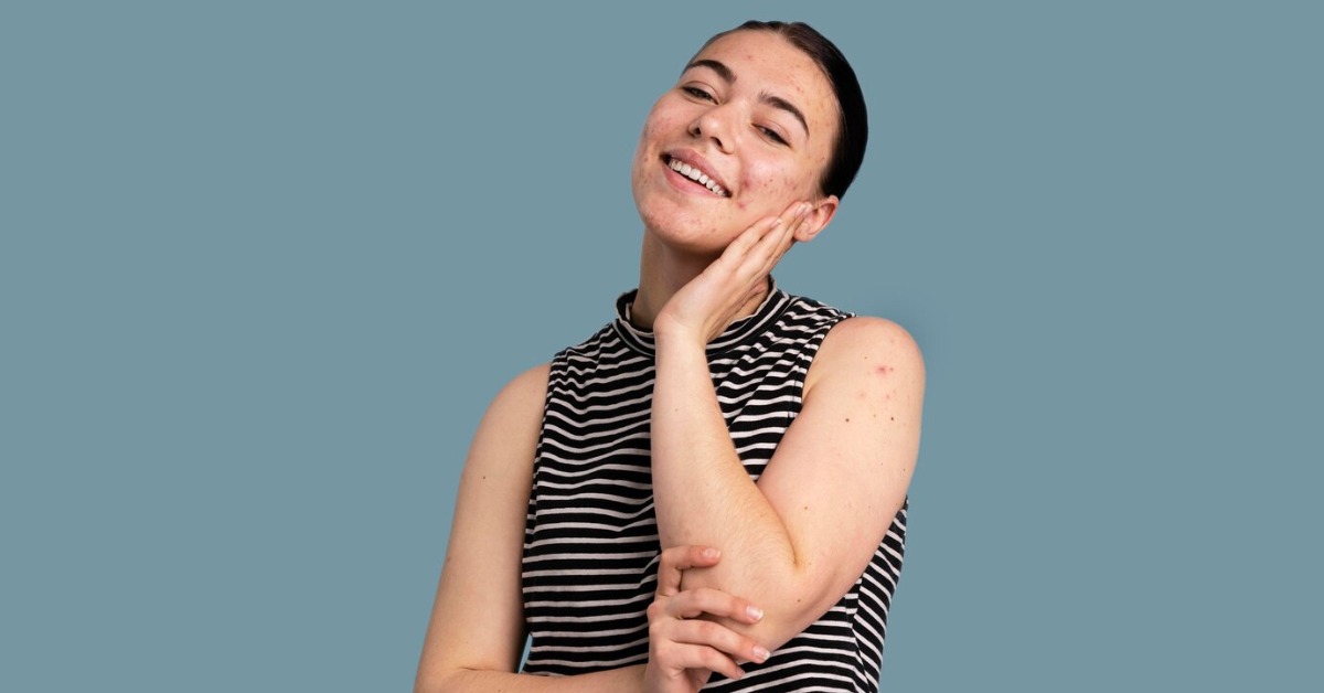 पीली त्वचा