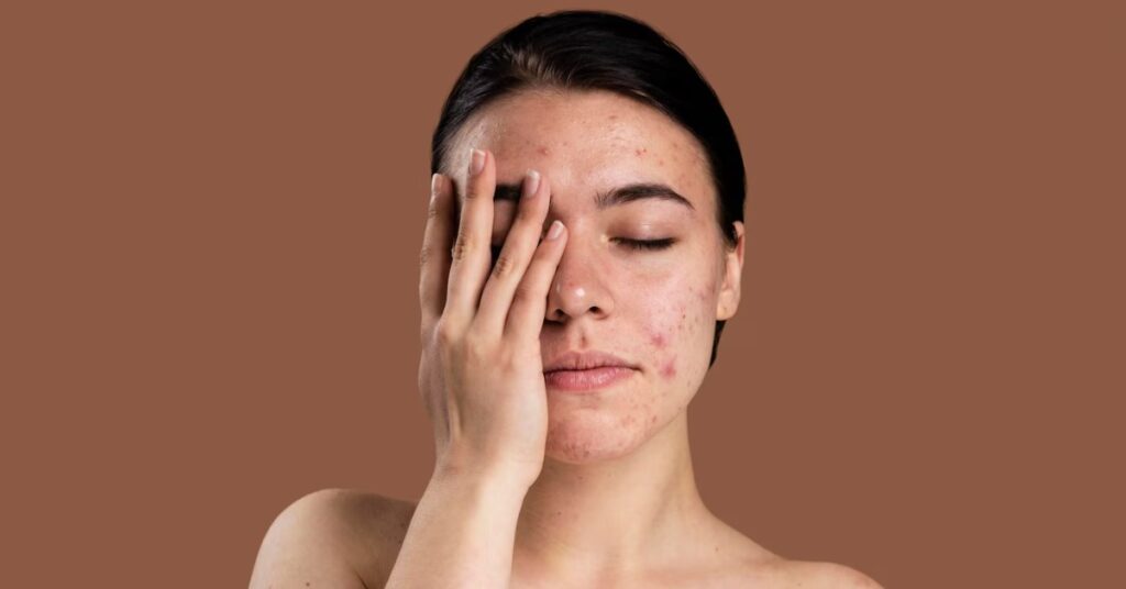 त्वचा का रंग खराब होना